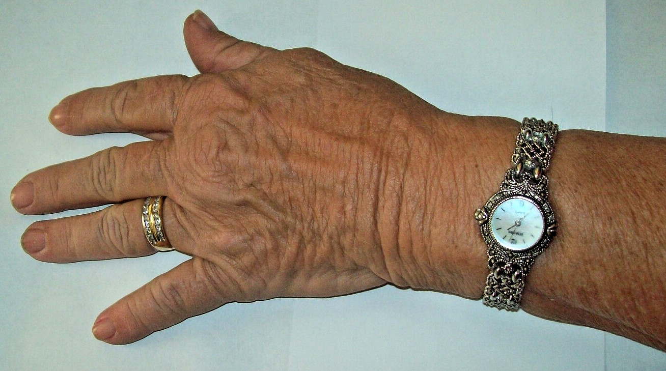 Rumours Fancy Filigree Watch Mother of Pearl fits 6.25″-6.5″ Looks Runs Great